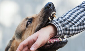 How Findlay Personal Injury Lawyers Can Help After a Dog Bite or Attack in Brantford