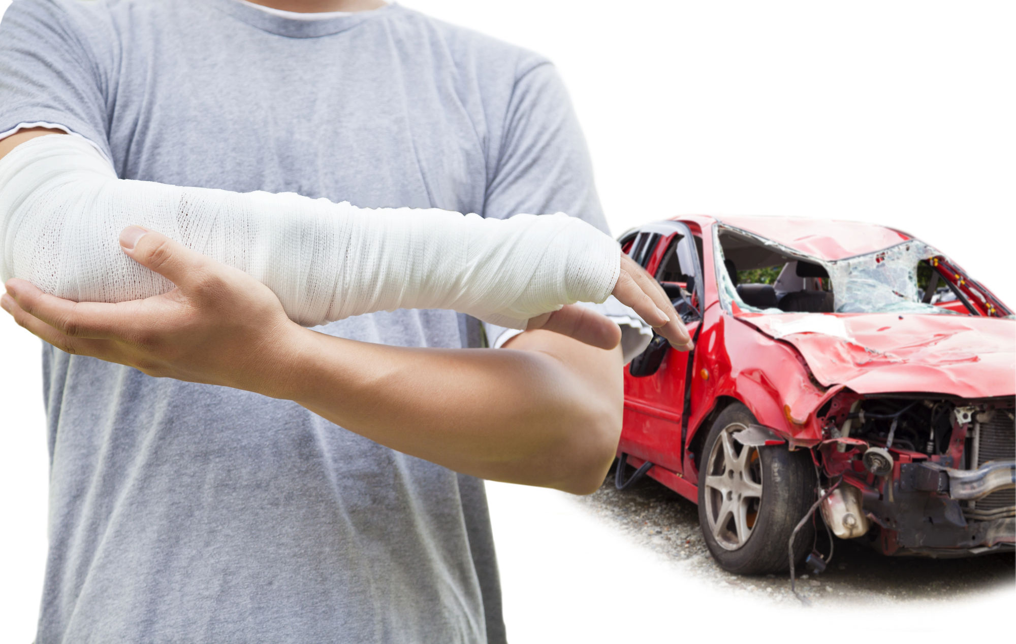 Person with a broken arm standing beside a damaged vehicle after being hit by an uninsured driver, illustrating uninsured driver claims and compensation in Ontario.
